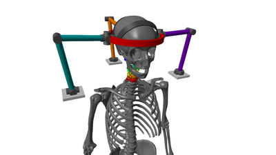 3-URS parallel mechanism positioned around a human head and neck model.